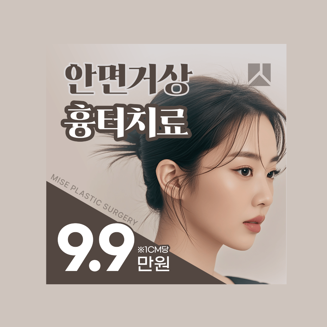 이벤트 1 이미지